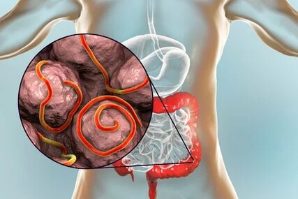 Parasites in the intestines