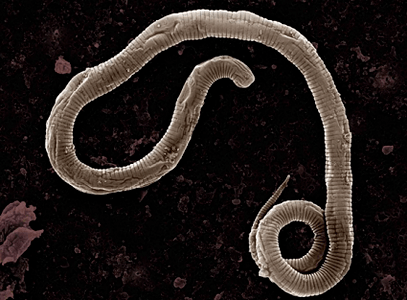 From which worms in the human body come from