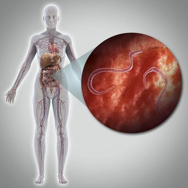 Parasites in one's body