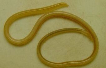 The parasite type in the human body