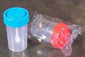 containers for parasite testing