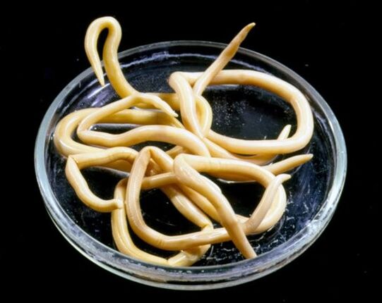 worms from the human body