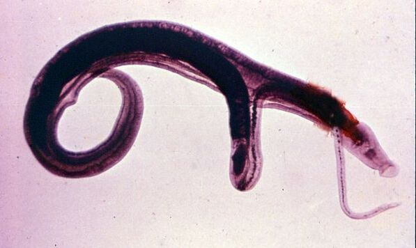 Schistosoma is one of the most common and dangerous parasites